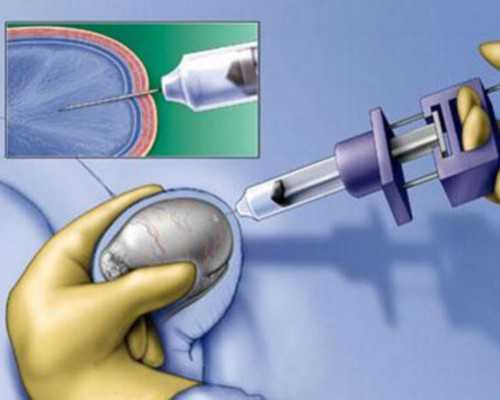 北京代生及费用,北京靠谱的供卵试管机构 北京代生及费用,北京靠谱的供卵试管机构
