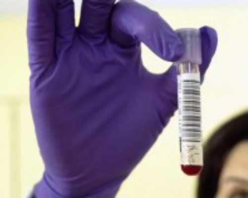 囊胚移植是打针好还是塞药好，囊胚移植中的打针和药物注入的优势及特点