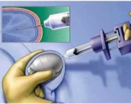 北京代孕专业公司,北京孕妇要做核酸检测吗？附北京陆军总医院试管婴儿医生评价！