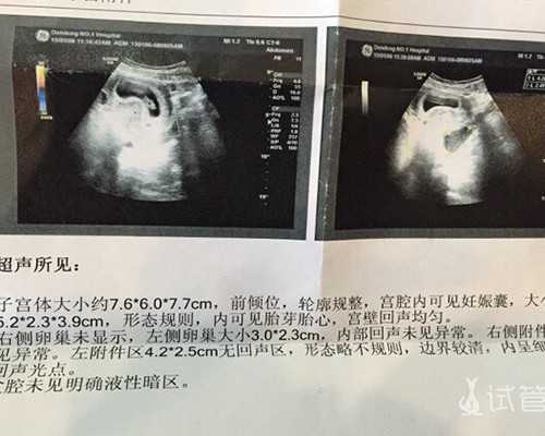 君乐宝优萃奶粉优点对比缺点，看完就知道值不值得买